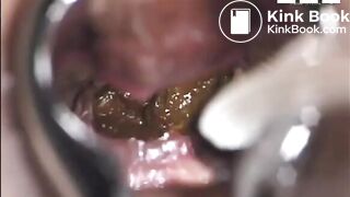 Einblick, ScatKings.com Scat Porn 10 ScatKings.com Scat Porn