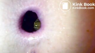 Huge shitty gape, ScatKings.com Scat Porn 6 ScatKings.com Scat Porn