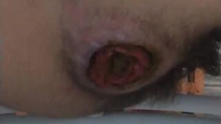 Ruined asshole shits for me, ScatKings.com Scat Porn 5 ScatKings.com Scat Porn